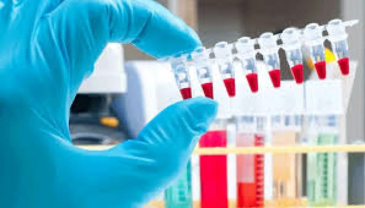 NOVA ANTIDOPING PRAVILA U BOSNI I HERCEGOVINI