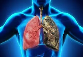 Свјетски дан хроничне опструктивне плућне болести (КОПБ)  