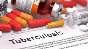 СВЈЕТСКА ЗДРАВСТВЕНА ОРГАНИЗАЦИЈА „ПОЗИВ НА АКЦИЈУ С ЦИЉЕМ ГЛОБАЛНОГ ПОВЕЋАЊА ПРЕВЕНЦИЈЕ ТУБЕРКУЛОЗЕ“