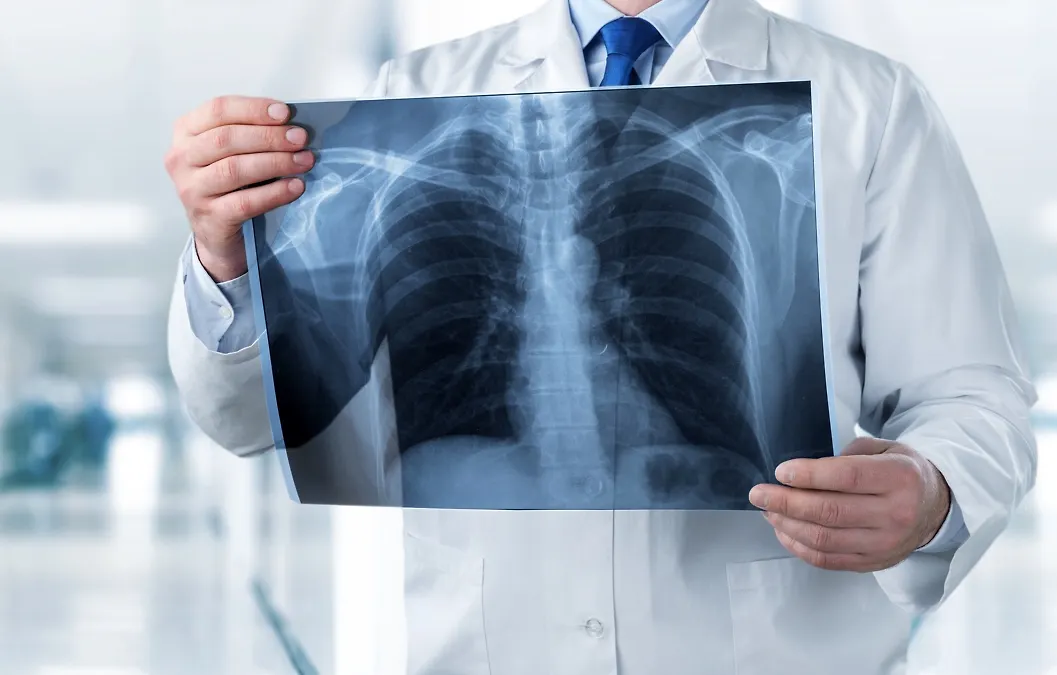 Уз координацију Министарства цивилних послова, НАТО обучава медицинско особље за употребу преносивих рендгенских уређаја